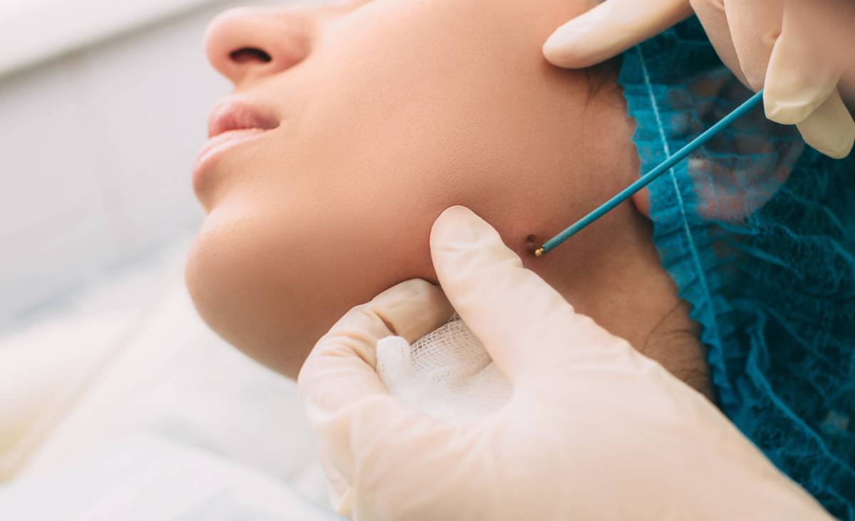 How-Modern-Electrocautery-Improves-Surgical-Precision-_-Carnelian-Medspa-Wellness.jpg