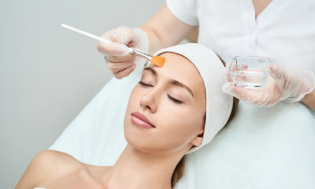 Chemical Peel for Glowing Skin